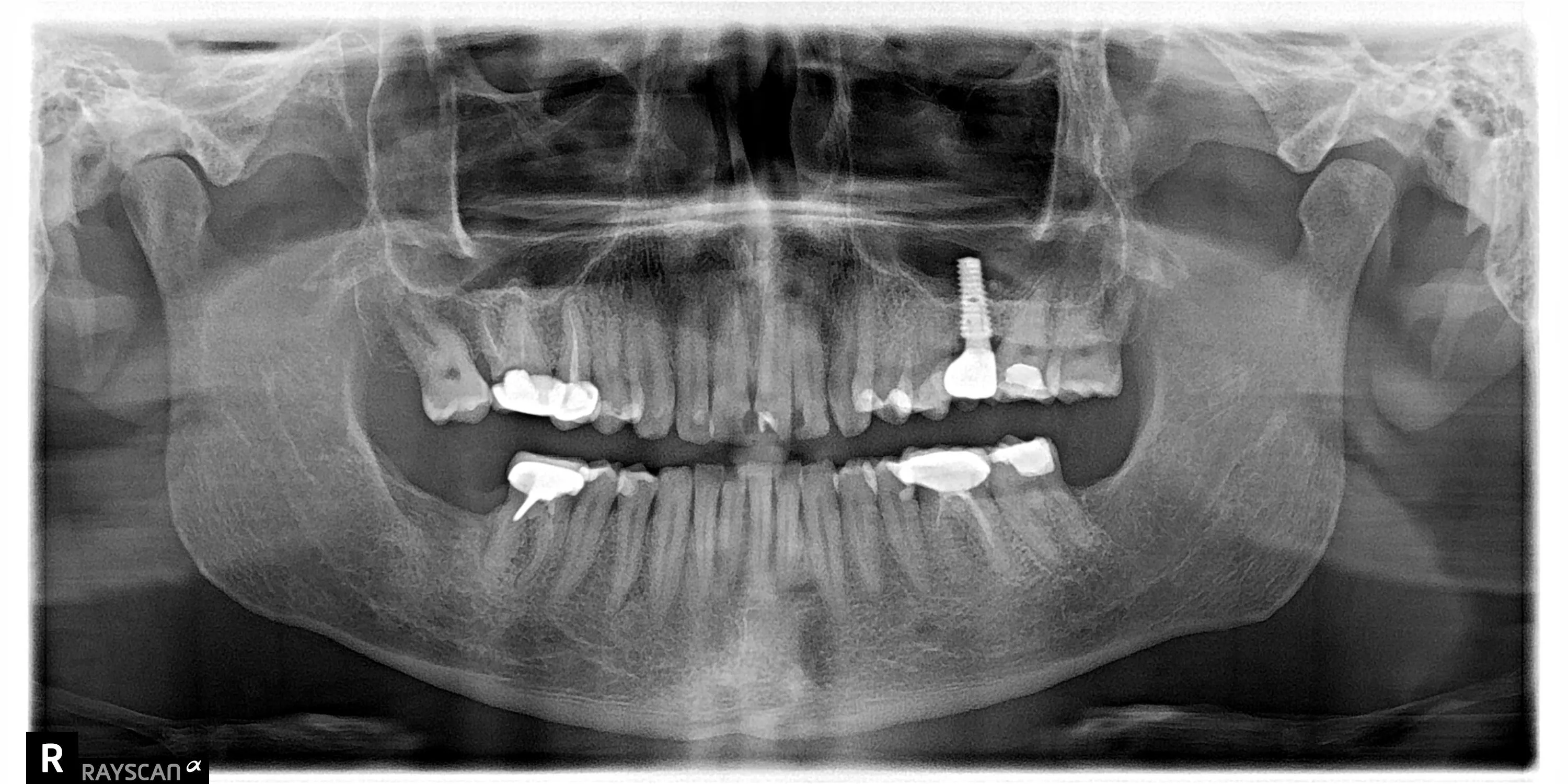 Cabinetul de radiologie dentară Cheo Klinik